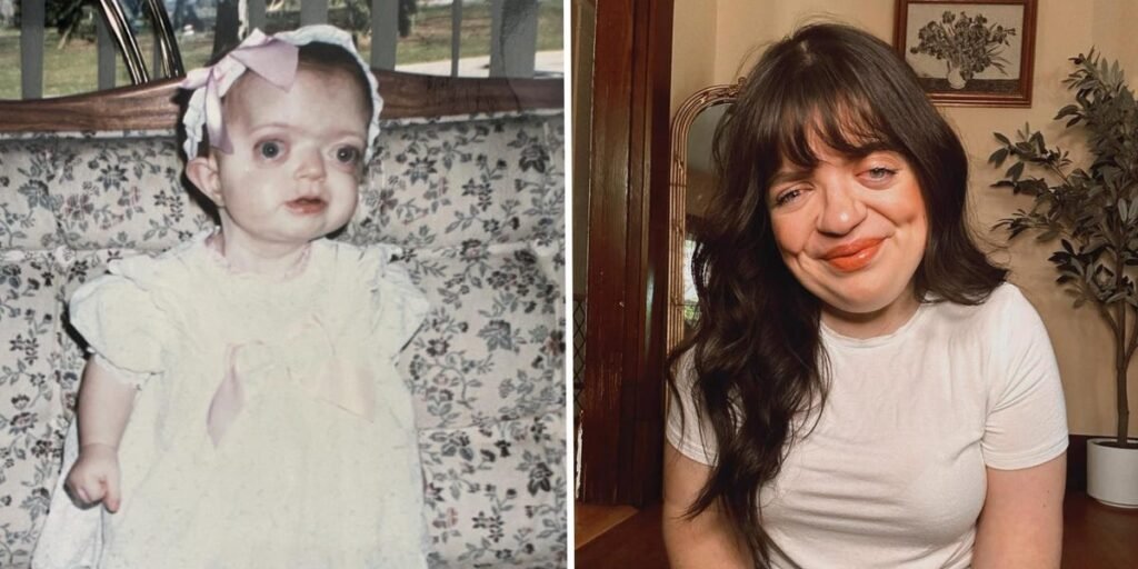 I’m a Proud Woman Who Embraces My Facial Differences