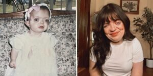 I’m a Proud Woman Who Embraces My Facial Differences I’m a Proud Woman Who Embraces My Facial Differences