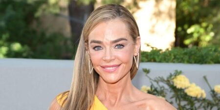 The facelift is going mainstream, and Denise Richards is proof