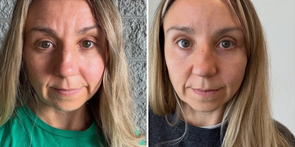 I get Botox as often as I can afford it. My aging face started to distract me on work calls — the cost is worth every penny.