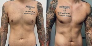 Men get cosmetic surgery, too. I spent ,000 on plastic surgery, and I don’t regret it. Men get cosmetic surgery, too. I spent ,000 on plastic surgery, and I don’t regret it.