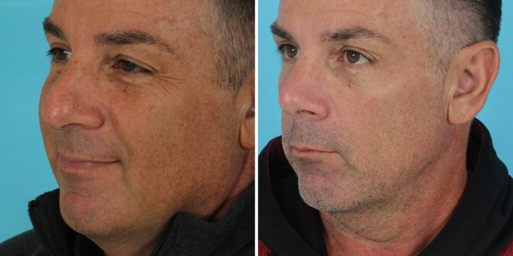 I’m a retired firefighter. I spent ,000 on plastic surgery in my 50s, and I’m not ashamed. I’m a retired firefighter. I spent ,000 on plastic surgery in my 50s, and I’m not ashamed.